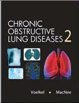Chronic Obstructive Lung Disease:  9781550093902 Front Cover