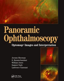 Panoramic Ophthalmoscopy Optomap Images and Interpretation  9781556427800 Front Cover