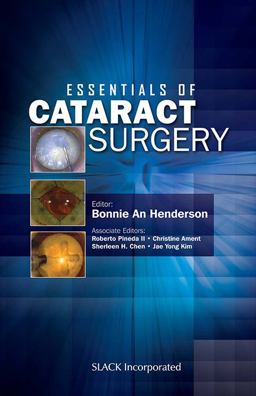 Essentials of Cataract Surgery  9781556428029 Front Cover