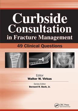 Curbside Consultation in Fracture Management 49 Clinical Questions  9781556428296 Front Cover