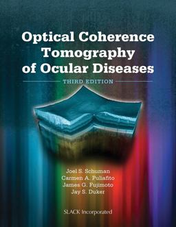 Optical Coherence Tomography of Ocular Diseases 3rd 9781556428647 Front Cover