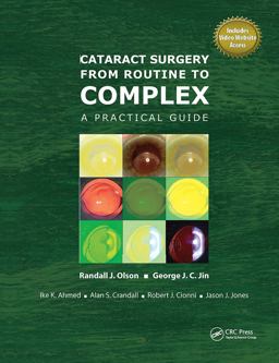 Cataract Surgery from Routine to Complex A Practical Guide  9781556429477 Front Cover