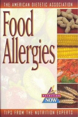Food Allergies Food Allergies