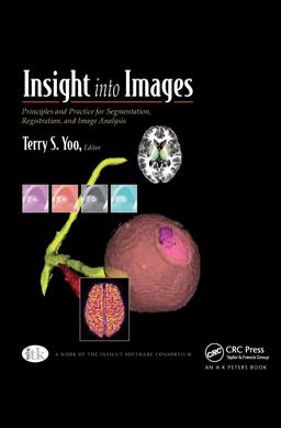 Insight into Images Principles and Practice for Segmentation, Registration, and Image Analysis  9781568812175 Front Cover