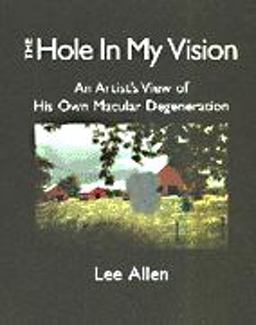 The Hole in My Vision