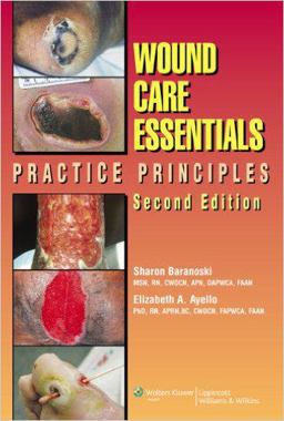 Wound Care Essentials Practice Principles 2nd 9781582554693 Front Cover