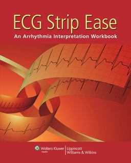 ECG Strip Ease ECG Strip Ease
