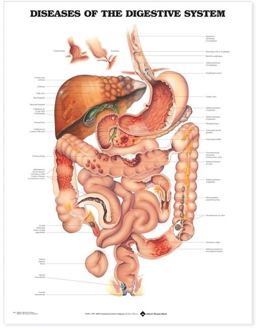 Diseases of the Digestive System Anatomical Chart  9781587792373 Front Cover