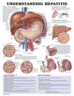 Understanding Hepatitis Anatomical Chart  9781587794179 Front Cover