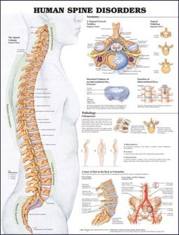 Human Spine Disorders Anatomical Chart 2nd 9781587794438 Front Cover