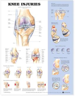 Knee Injuries Anatomical Chart  9781587797569 Front Cover
