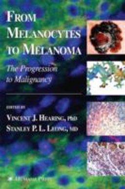 From Melanocytes to Melanoma The Progression to Malignancy  9781588294593 Front Cover