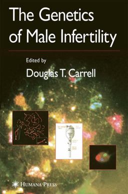 Genetics of Male Infertility  9781588298638 Front Cover