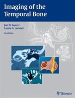 Imaging of the Temporal Bone 4th 9781588903457 Front Cover