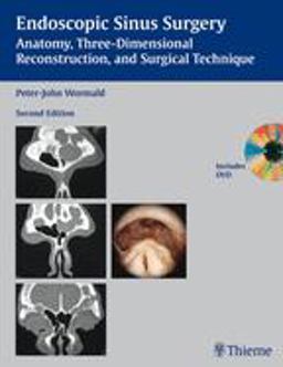 Endoscopic Sinus Surgery Anatomy, Three-Dimensional Reconstruction, and Surgical Technique 2nd 9781588906038 Front Cover