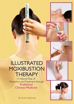 Illustrated Moxibustion Therapy A Natural Way of Prevention and Treatment Through Traditional Chinese Medicine  9781602200371 Front Cover