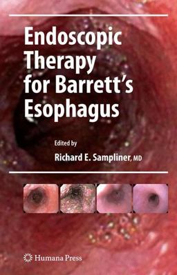 Endoscopic Therapy for Barrett's Esophagus  9781603274449 Front Cover
