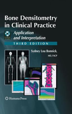 Bone Densitometry in Clinical Practice Application and Interpretation 3rd 9781603274982 Front Cover
