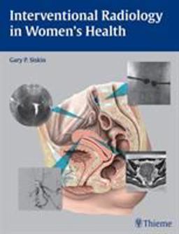 Interventional Radiology in Women's Health  9781604060461 Front Cover