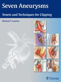 Seven Aneurysms Tenets and Techniques for Clipping  9781604060546 Front Cover