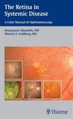 Retina in Systemic Disease A Color Manual of Ophthalmoscopy  9781604060553 Front Cover