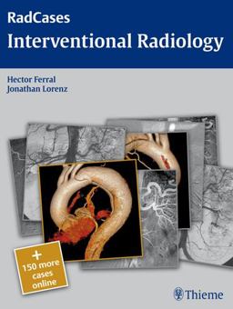 Interventional Radiology