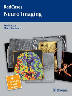 Neuro Imaging  9781604061895 Front Cover