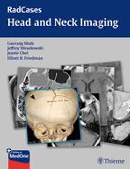 RadCases Head and Neck Imaging  9781604061932 Front Cover