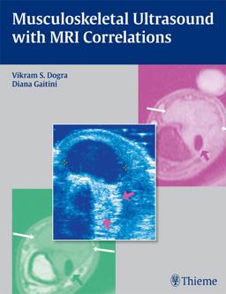 Musculoskeletal Ultrasound with MRI Correlations  9781604062441 Front Cover
