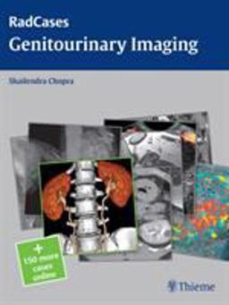 Radcases Genitourinary Imaging  9781604063240 Front Cover