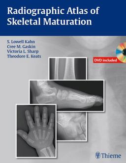 Radiographic Atlas of Skeletal Maturation  9781604065718 Front Cover