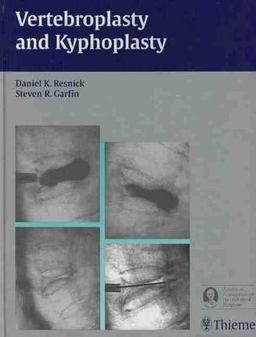 Vertebroplasty and Kyphoplasty Vertebroplasty and Kyphoplasty