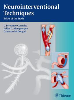 Neurointerventional Techniques Tricks of the Trade  9781604067576 Front Cover