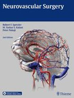 Neurovascular Surgery 2nd 9781604067590 Front Cover