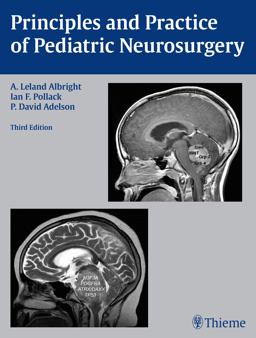 Principles and Practice of Pediatric Neurosurgery 3rd 9781604067996 Front Cover
