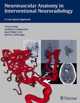 Neurovascular Anatomy in Interventional Neuroradiology A Case-Based Approach  9781604068399 Front Cover