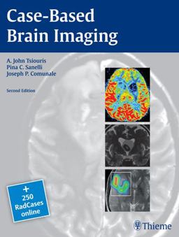 Case-Based Brain Imaging 2nd 9781604069532 Front Cover