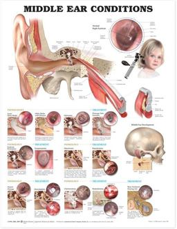 Middle Ear Conditions Anatomical Chart 2nd 9781605470955 Front Cover