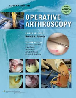 Operative Arthroscopy 4th 9781605478609 Front Cover