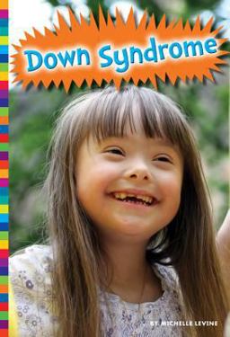 Down Syndrome Down Syndrome