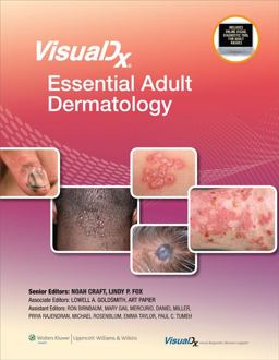 VisualDx: Essential Adult Dermatology  9781608318056 Front Cover