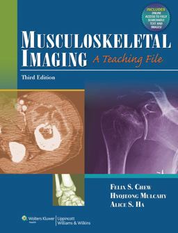 Musculoskeletal Imaging A Teaching File 3rd 9781609137939 Front Cover