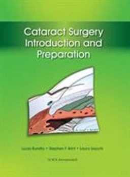Cataract Surgery Introduction and Preparation  9781617116056 Front Cover