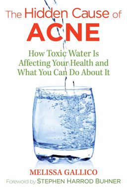 Hidden Cause of Acne How Toxic Water Is Affecting Your Health and What You Can Do about It 2nd 9781620557099 Front Cover