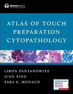 Atlas of Touch Preparation Cytopathology  9781620700686 Front Cover