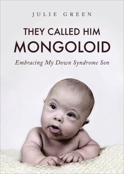 They Called Him Mongoloid