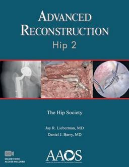 Advanced Reconstruction Hip 2 2nd 9781625525574 Front Cover