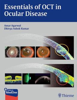 Essentials of OCT in Ocular Disease Essentials of OCT in Ocular Disease