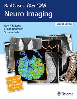 RadCases Plus Q&amp;a Neuro Imaging 2nd 9781626232372 Front Cover