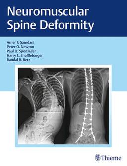 Neuromuscular Spine Deformity  9781626232600 Front Cover